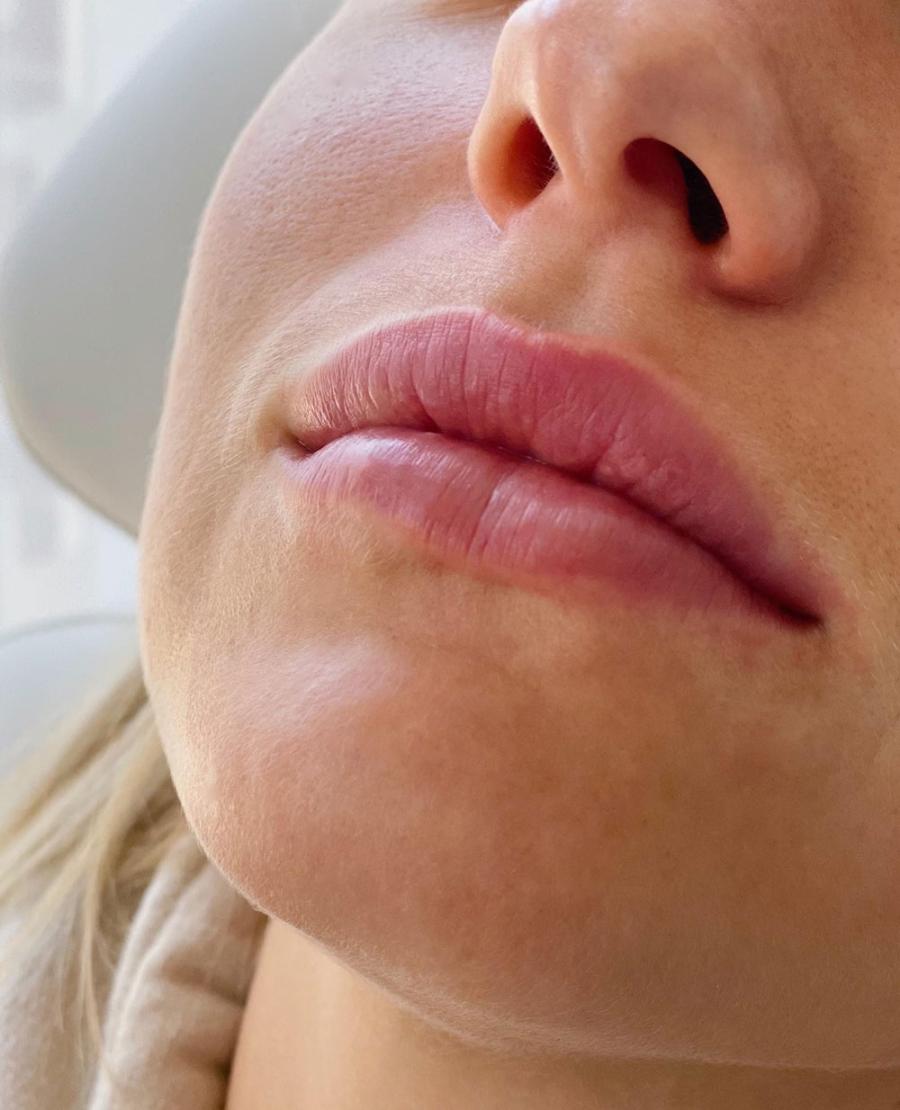 Volumizing lips Doctors at Soap